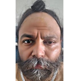 patient Image